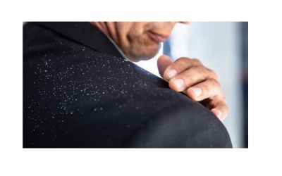 Melhor shampoo anticaspa 2026